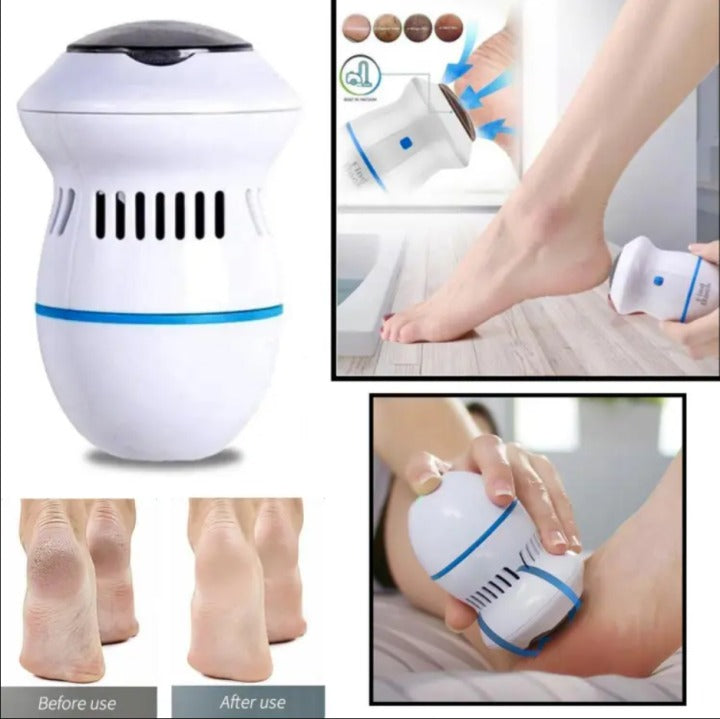 Electric Foot Pedicure Grinder | Rechargeable Callus Remover | Professional Foot File for Dead Skin & Heel Care